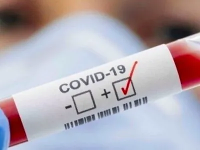 МОЗ планує дозволити лікарям "первинки" відбирати матеріали для тестування пацієнтів на COVID-19