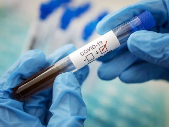 На Донеччині за добу виявили понад півтисячі нових випадків COVID-19