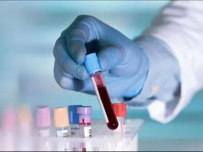Масове тестування на антитіла дасть неоціненну інформацію про COVID-19 – науковці