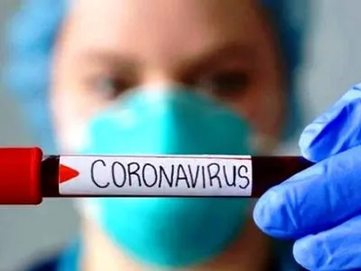 Серед працівників Апарату ВР та нардепів 61 людина хворіє на COVID-19 - Кондратюк