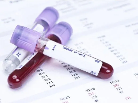 У Британії почнуть випробування аналізу крові, що виявляє 50 типів раку