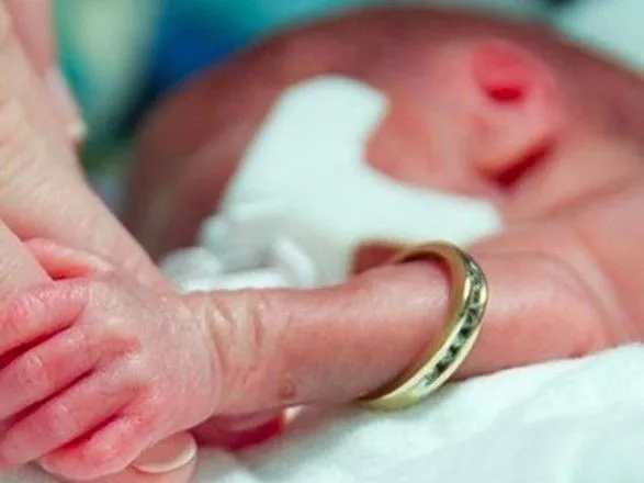 В Украине ежегодно рождается до 6 тыс. недоношенных малишей