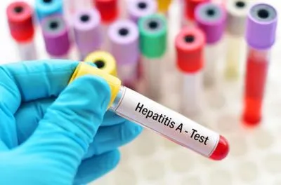 Вспышка вирусного гепатита А в Одесской области: трех пациентов уже выписаны