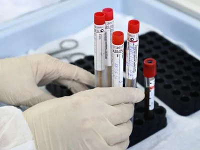 На Буковині за добу зафіксували 596 нових випадків коронавірусу