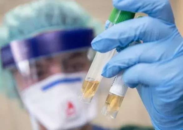 На Буковине за сутки зафиксировали 543 случая коронавируса