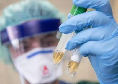 На Буковине за сутки зафиксировали 543 случая коронавируса