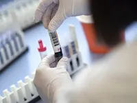 На Буковине за сутки зафиксировали 254 случая коронавируса