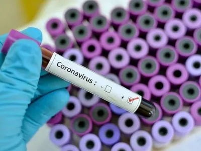 Как антигенные тесты используют для борьбы с пандемией COVID-19