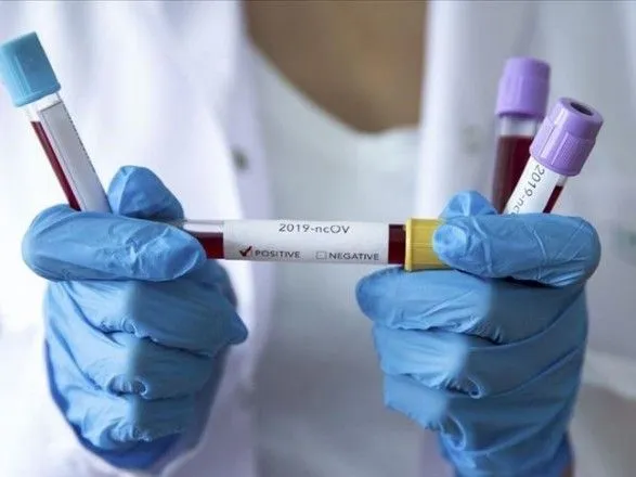 На Буковині виявили 39 нових випадків коронавірусу за добу