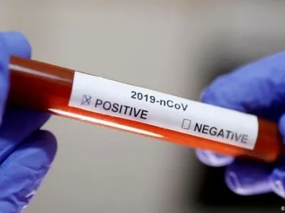 На Буковине обнаружили 22 новых случая коронавируса в сутки
