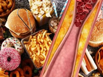 Лікар-дієтолог з США допомогла розібратися в порадах по холестерину, які збивають з пантелику