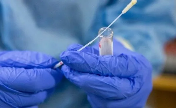На Буковине обнаружили 28 новых случаев коронавируса в сутки