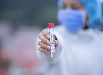 На Буковині виявили 24 нових випадки коронавірусу за добу