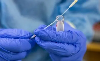 На Буковині виявили всього 11 нових випадків коронавірусу за добу