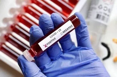 На Буковине обнаружили 3 новых случая коронавируса в сутки