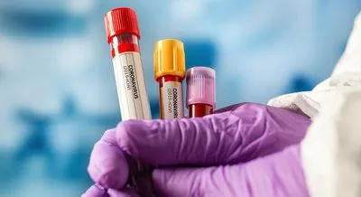 На Буковині виявили 4 нові випадки коронавірусу за добу