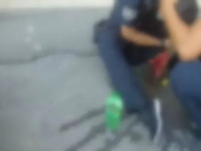 Полицейскому, которого ранил "голосеевский стрелок", врачи "собирают" кости кисти руки