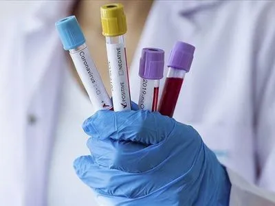 В Херсонской области зафиксировали 34 новых случая коронавируса за сутки