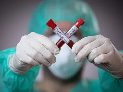 В Украине выявлено 17 случаев коронавируса штамма "Дельта"