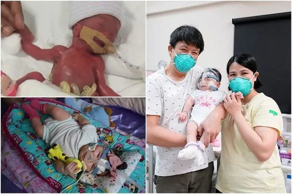 Після понад року лікування: найменшу у світі новонароджену дитину виписали з лікарні