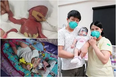 После более года лечения: самого маленького в мире новорожденного ребенка выписали из больницы