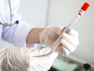 Частка заражень "Дельта"-штамом коронавірусу в Україні наразі невідома - учені