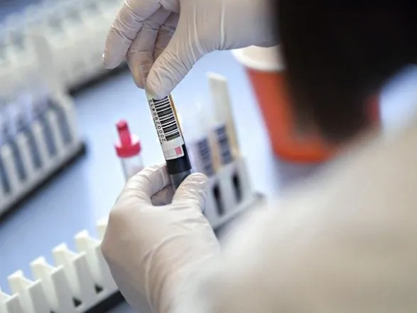 На Буковине обнаружили 34 новых случая коронавируса в сутки