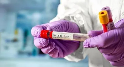 На Буковині виявили 55 нових випадків коронавірусу за добу