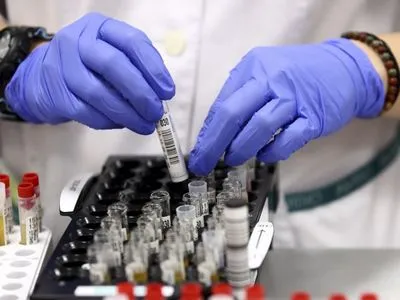 На Херсонщині зафіксували 25 нових випадків коронавірусу за добу