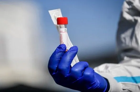 На Херсонщине зафиксировали 120 новых случаев коронавируса в сутки