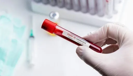 На Херсонщині зафіксували 30 нових випадків коронавірусу за добу