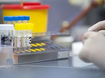 Использование ИФА-теста на антиген коронавируса может снять нагрузку с лабораторных центров - врач