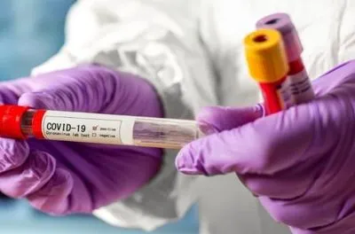 На Буковині виявили 298 нових випадків коронавірусу за добу