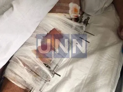 Ранения бедра: стали известны детали травмы водителя Шефира