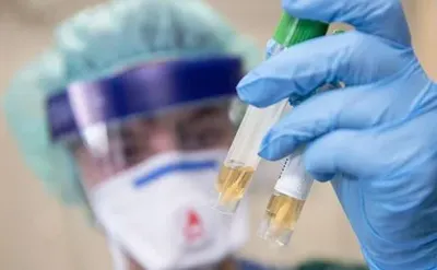 На Буковині виявили 585 нових випадків коронавірусу за добу
