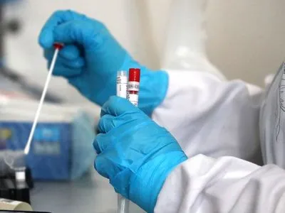 На Буковине зафиксировали 447 новых случаев инфицирования коронавируса