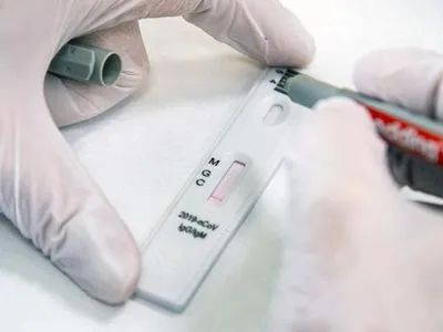 ІФА-тестування на антитіла перед вакцинацією зменшило б острах людей щодо щеплення від коронавірусу - експерт
