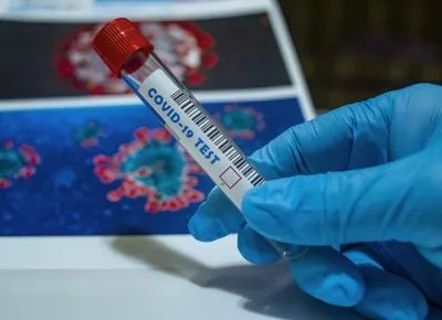 На Херсонщині виявили 1084 нових випадків коронавірусу