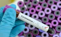 На Буковині виявили 499 нових випадків інфікування коронавірусом