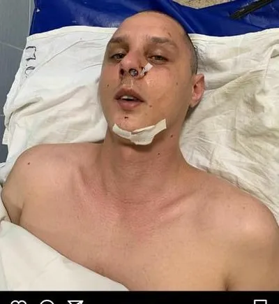 В Киеве жестоко избили в подъезде автора песен группы KAZKA