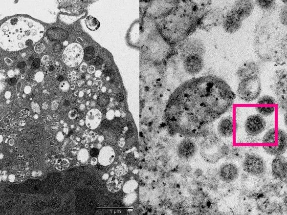 Омікрон може викликати величезну хвилю захворюваності на коронавірус по всьому світу - вчені