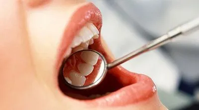 9 лютого — Міжнародний день стоматолога
