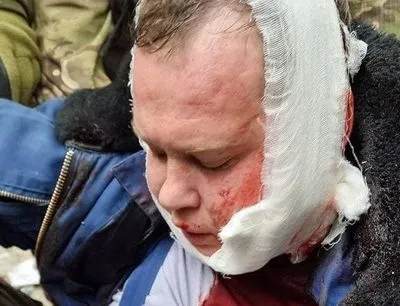 Украинские военные сбили вражеский штурмовик под Черниговом, пилота задержали