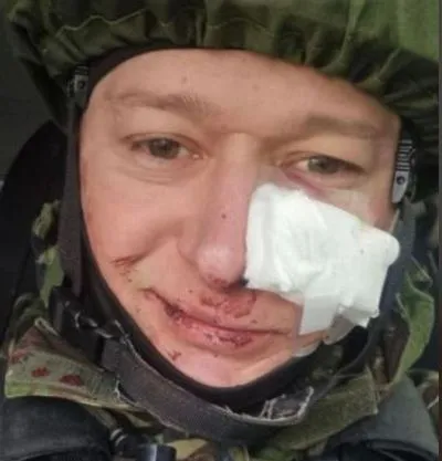 Лидер группы "Бумбокс" получил ранения во время минометного обстрела