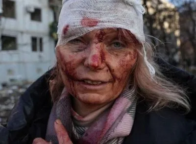 Портрет пораненої жительки Чугуєва продали за 100 тисяч доларів: гроші передадуть ЗСУ та Нацгвардії