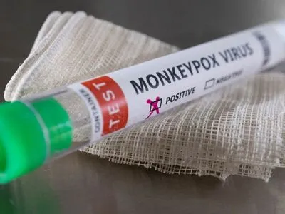 В Ірландії повідомили про перший випадок зараження вірусом мавпячої віспи