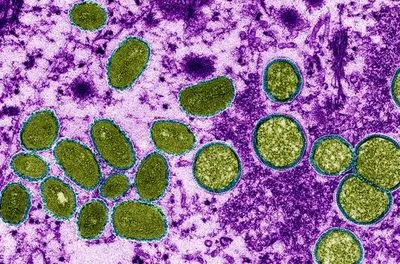 ВООЗ попереджає про зростання захворюваності на коронавірус і мавпячу віспу