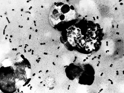 Китай повідомив про випадок зараження людини бубонною чумою