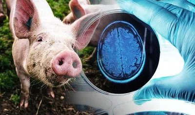Ученым удалось оживить клетки и органы мертвых свиней: человечеству необходимо пересмотреть определение понятия "смерти"