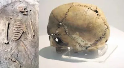 Ученые показали череп, на котором провели операцию головного мозга более 9 500 лет назад